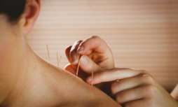 The Science of Acupuncture